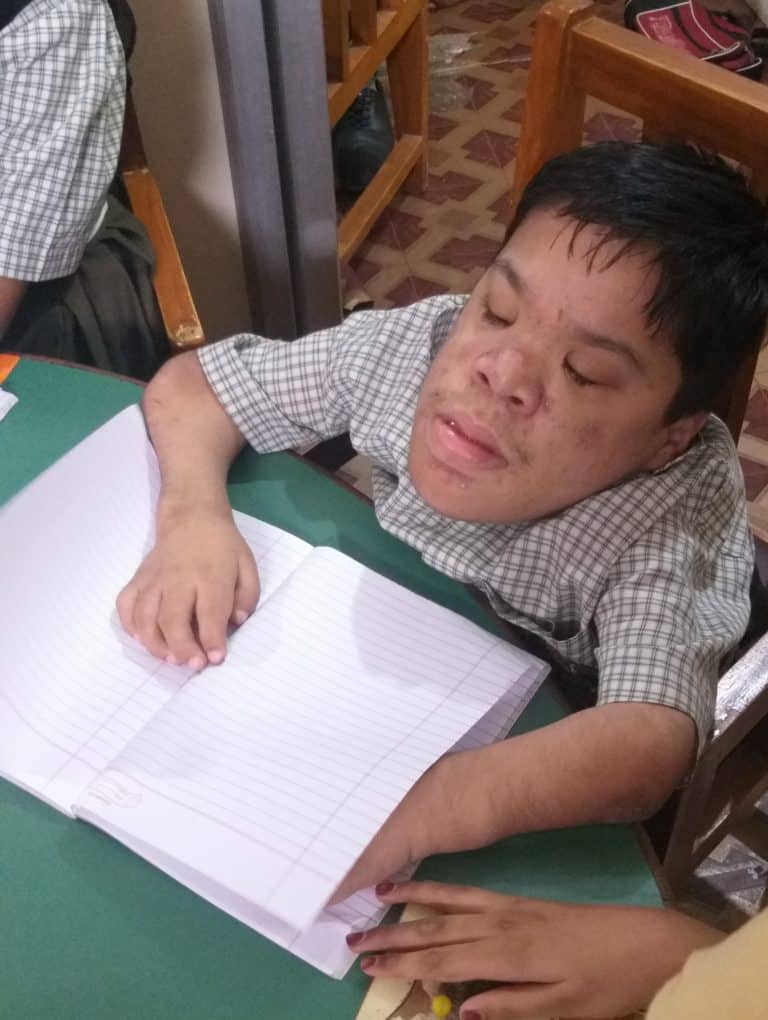 Mohammad Zaid looks younger than his age because of the deformities caused as the side effect of contamination