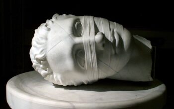 PATIENTS OF AUTISM AND THEIR LUGUBRIOUS CONDITION